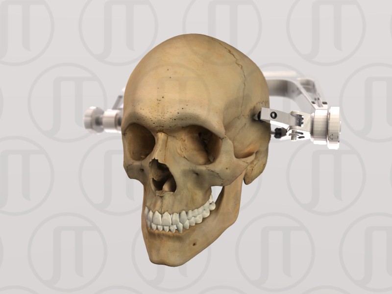 Mayfield Skull Clamp